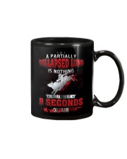 Collapsed lung 02 Mug thumbnail