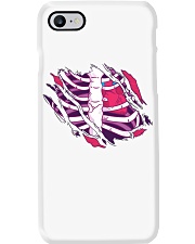 Exposing organs Phone Case i-phone-7-case