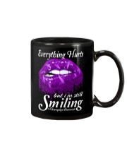 Fibromyalgia Awareness Lip Everything Hurts Mug tile