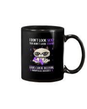 Fibromyalgia Awareness Grumpy Cat I Don't Look Sick Mug tile
