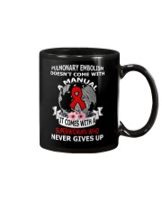 Pulmonary Embolism shirt Mug thumbnail