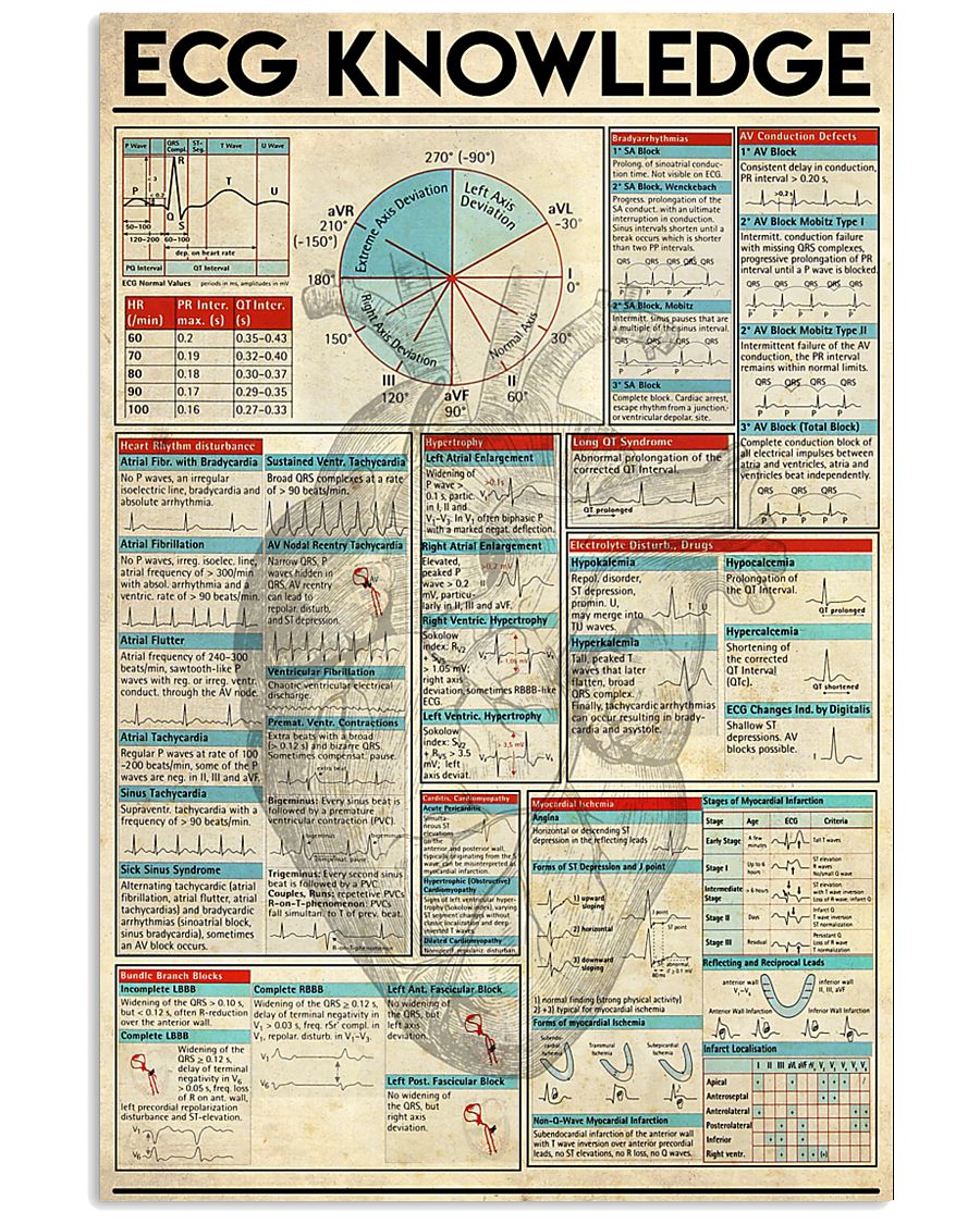 ECG 11x17 Poster