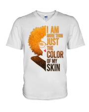 MORE THAN SKIN T-SHIRT V-Neck T-Shirt thumbnail