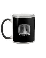 THE X-RAY OF MY HEART Color Changing Mug color-changing-left