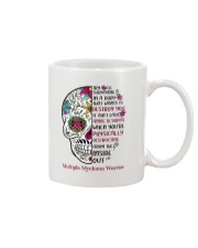 1 DAY LEFT - GET YOURS NOW Mug tile