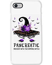 1 DAY LEFT - GET YOURS NOW Phone Case tile