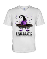1 DAY LEFT - GET YOURS NOW V-Neck T-Shirt tile