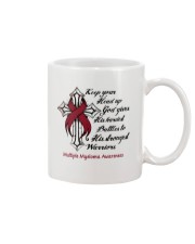 1 DAY LEFT - GET YOURS NOW Mug tile