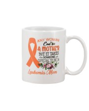 1 DAY LEFT - GET YOURS NOW Mug tile