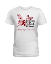1 DAY LEFT - GET YOURS NOW Ladies T-Shirt tile