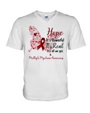1 DAY LEFT - GET YOURS NOW V-Neck T-Shirt tile