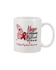 1 DAY LEFT - GET YOURS NOW Mug tile
