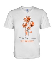 1 DAY LEFT - GET YOURS NOW V-Neck T-Shirt tile