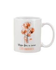 1 DAY LEFT - GET YOURS NOW Mug tile
