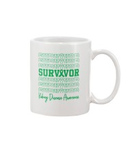 1 DAY LEFT - GET YOURS NOW Mug tile