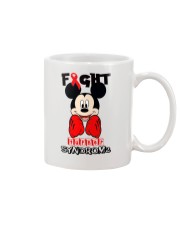 turner syndrome Mug thumbnail