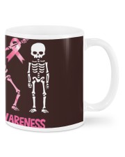 Dabbing Skeleton Pink Ribbon Mugs tile