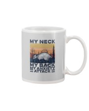 MY NECK MY BACK MY ANXIETY ATTACK Mug tile