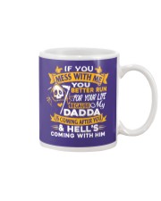 1 DAY LEFT - GET YOURS NOW Mug thumbnail