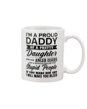 1 DAY LEFT - GET YOURS NOW Mug thumbnail