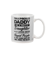 1 DAY LEFT - GET YOURS NOW Mug thumbnail