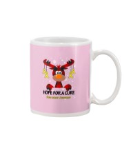 bone-cancer-yellow-hfac Mug thumbnail