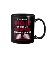multiple-myeloma-burgundy-3012 Mug thumbnail
