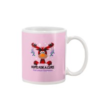 anal-cancer-purple-green-hfac Mug thumbnail