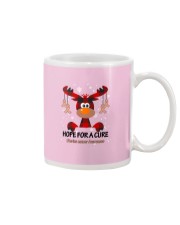 uterine-cancer-peach-hfac Mug thumbnail