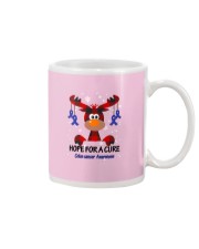 colon-cancer-darkblue-hfac Mug thumbnail