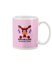 pancreatic-cancer-purple-hfac Mug thumbnail
