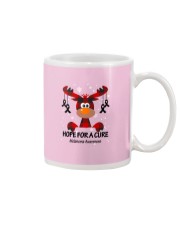 melanoma-black-hfac Mug thumbnail