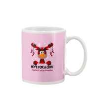 head-neck-cancer-burgundy-ivory-hfac Mug thumbnail