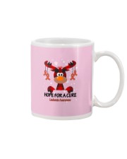 leukemia-orange-hfac Mug thumbnail