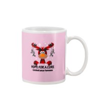 carcinoid-cancer-zebra-stripes-hfac Mug thumbnail