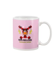 sarcoma-cancer-yellow-hfac Mug thumbnail