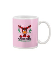 gallbladder-cancer-kellygreen-hfac Mug thumbnail