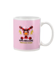 childhood-cancer-gold-hfac Mug thumbnail