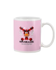 lung-cancer-white-hfac Mug thumbnail