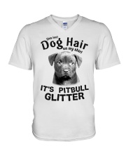 Pitbull This Is Not Dog Hair On My Shirt V-Neck T-Shirt tile