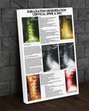 Chiropractor subluxation cervical lqt nna 24x36 Gallery Wrapped Canvas Prints aos-canvas-pgw-24x36-lifestyle-front-05