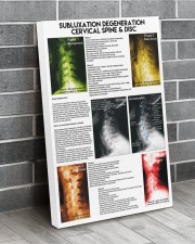 Chiropractor subluxation cervical lqt nna 24x36 Gallery Wrapped Canvas Prints aos-canvas-pgw-24x36-lifestyle-front-06