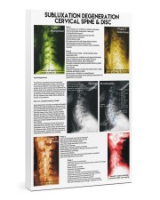 Chiropractor subluxation cervical lqt nna 24x36 Gallery Wrapped Canvas Prints front