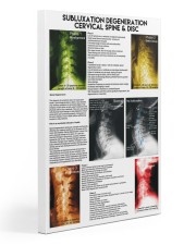 Chiropractor subluxation cervical lqt nna Gallery Wrapped Canvas Prints tile