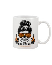 Not dead yet Mug tile