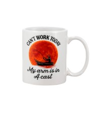 Can't work today my hand are in a cast Mug tile