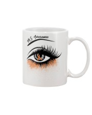 Multiple Sclerosis Awareness Mug tile