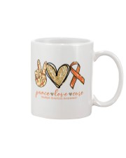Limited Edition - Printed apparels Mug tile