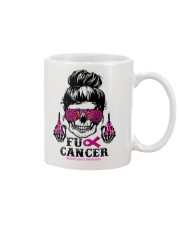 Breast Cancer Mug tile