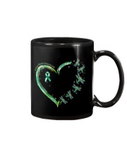Kidney Disease Awareness Mug tile